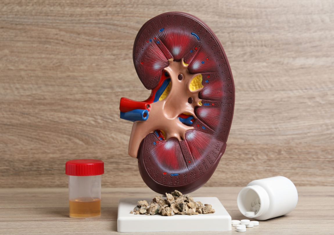 minuman sehat untuk ginjal