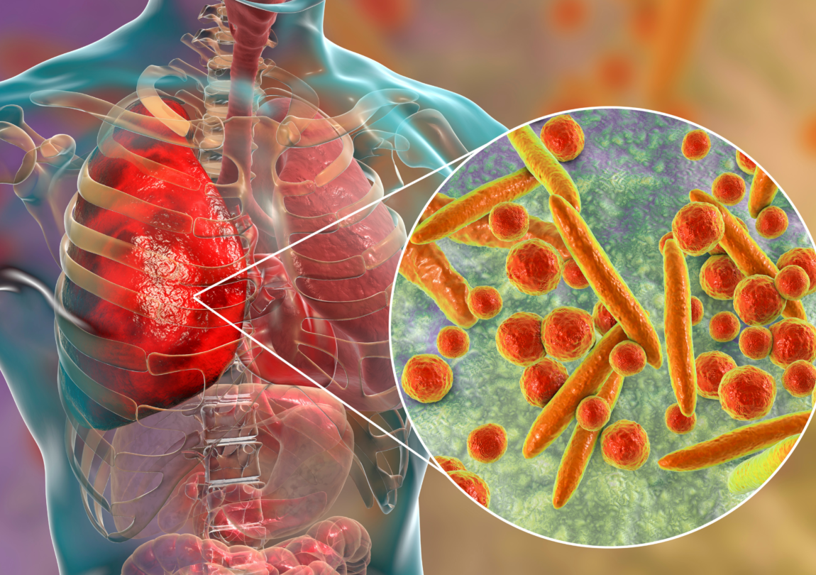 penyakit saat musim hujan