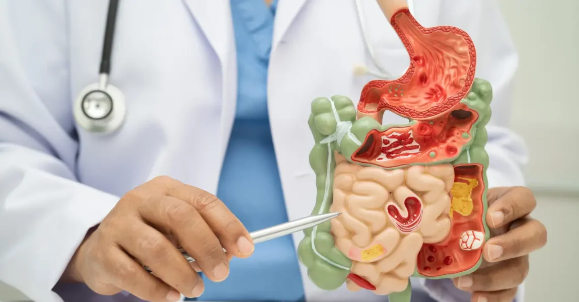 Asam Lambung Naik Harus Apa?