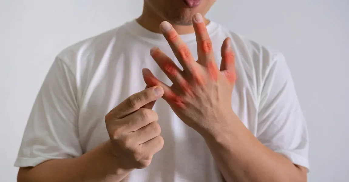 Terapi Air Putih untuk Asam Urat